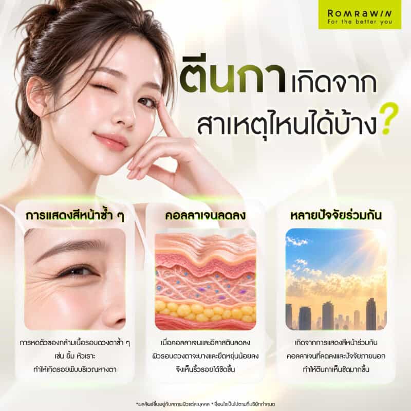 ตีนกาเกิดจากสาเหตุไหนได้บ้าง?