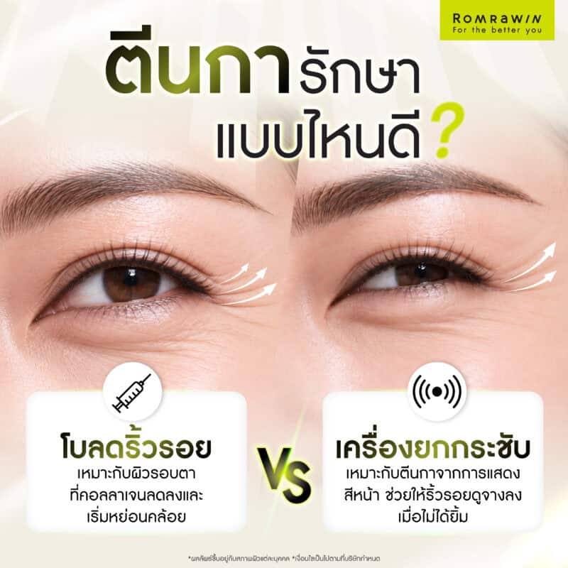 ตีนการักษาแบบไหนดี?