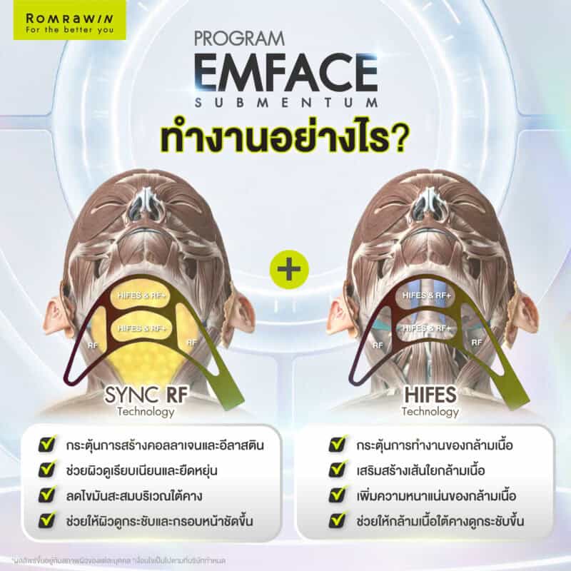EMFACE Submentum ทำงานอย่างไร?