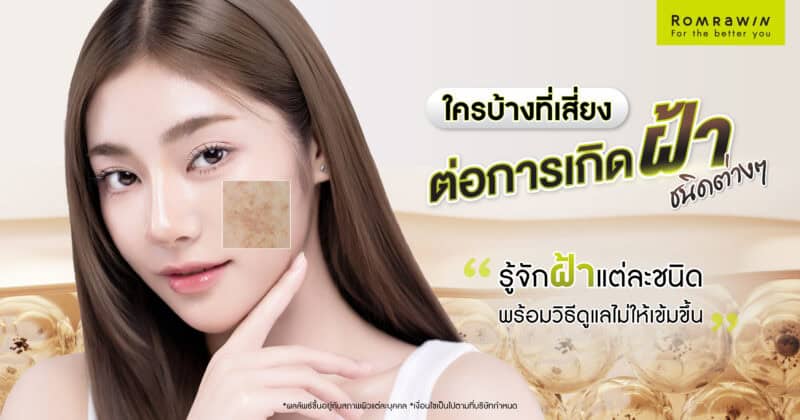 ใครบ้างที่เสี่ยงต่อการเกิดฝ้าชนิดต่างๆ