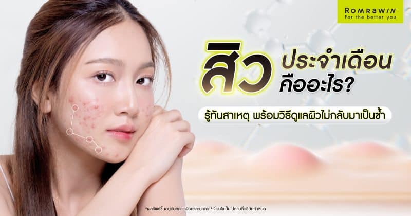 สิวประจำเดือน