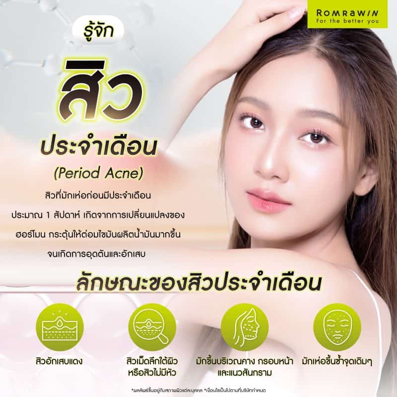 สิวประจำเดือน (Period Acne) คืออะไร?