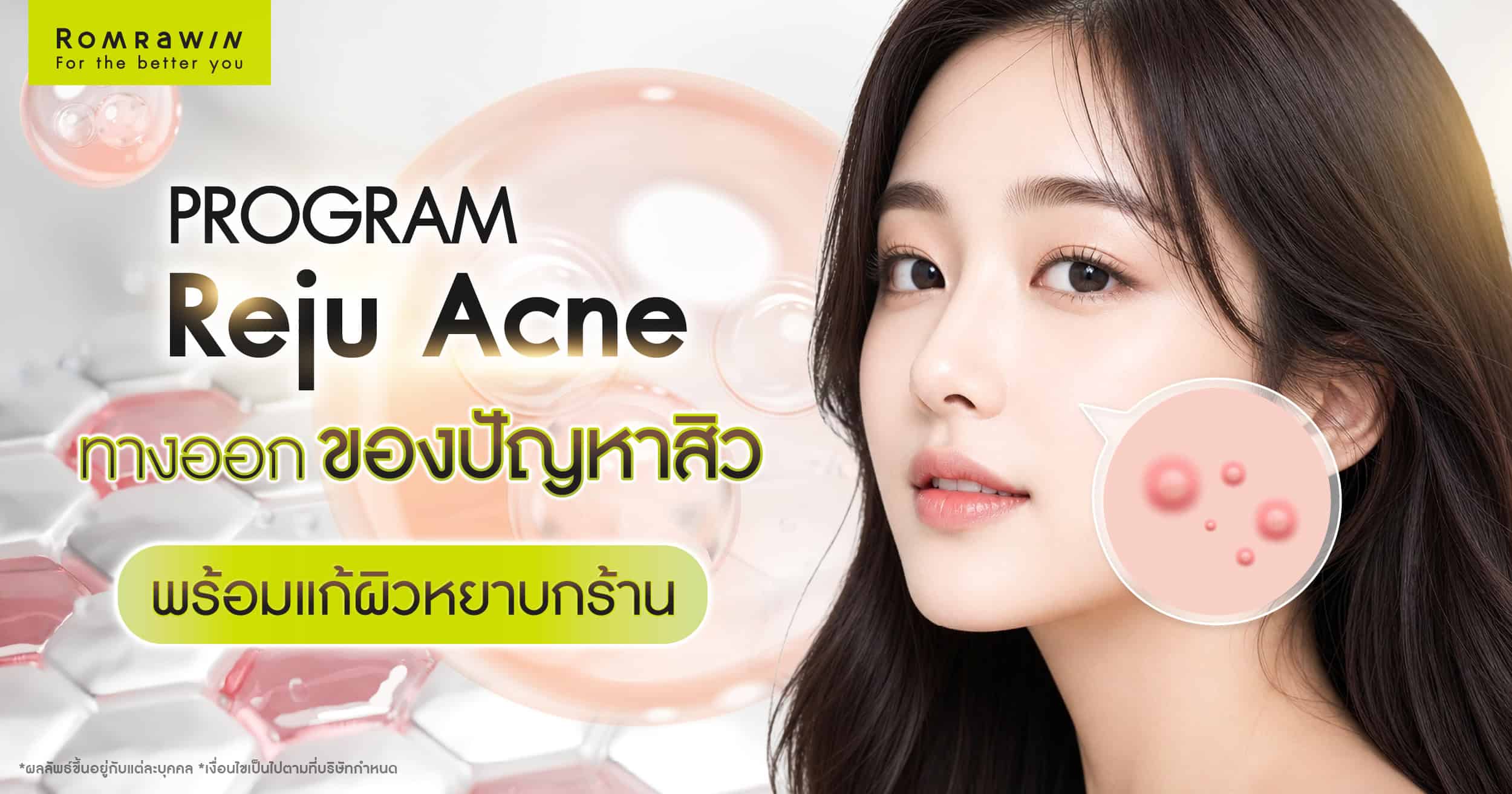 Reju Acne