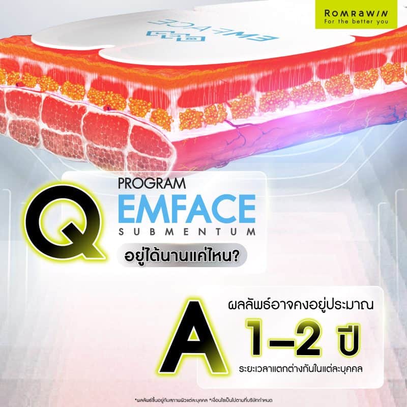 EMFACE Submentum อยู่ได้นานแค่ไหน?