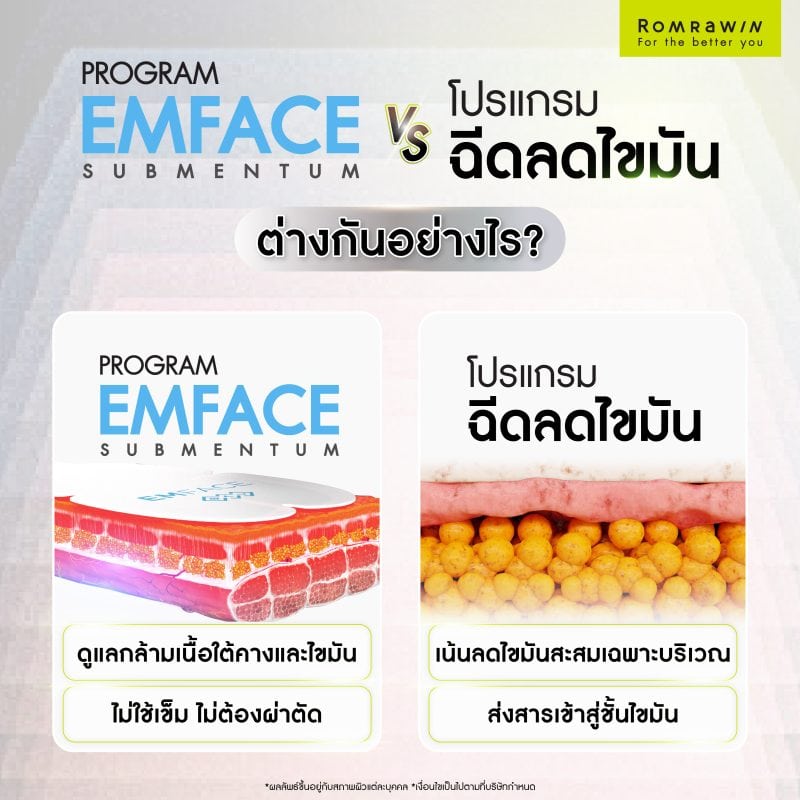 EMFACE Submentum vs โปรแกรมฉีดลดไขมันต่างกันอย่างไร?