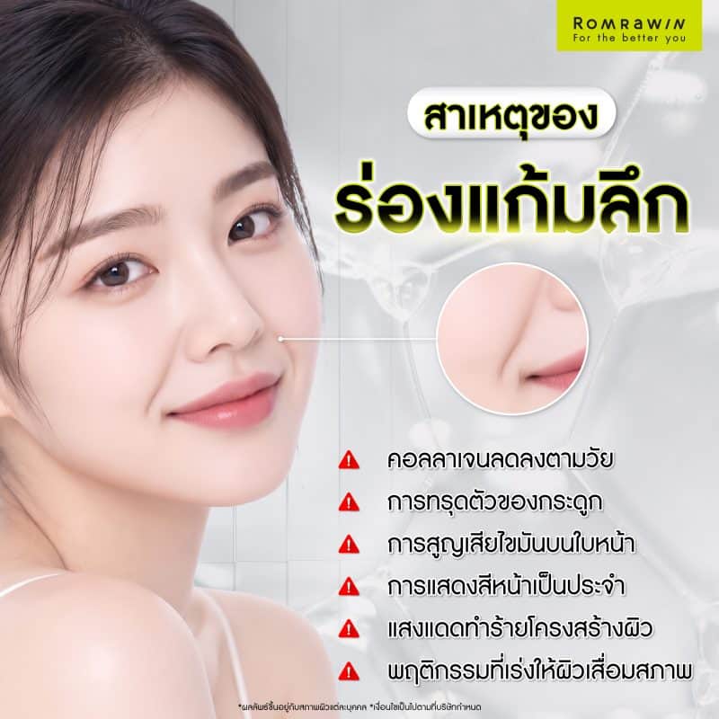 สาเหตุของร่องแก้มลึก