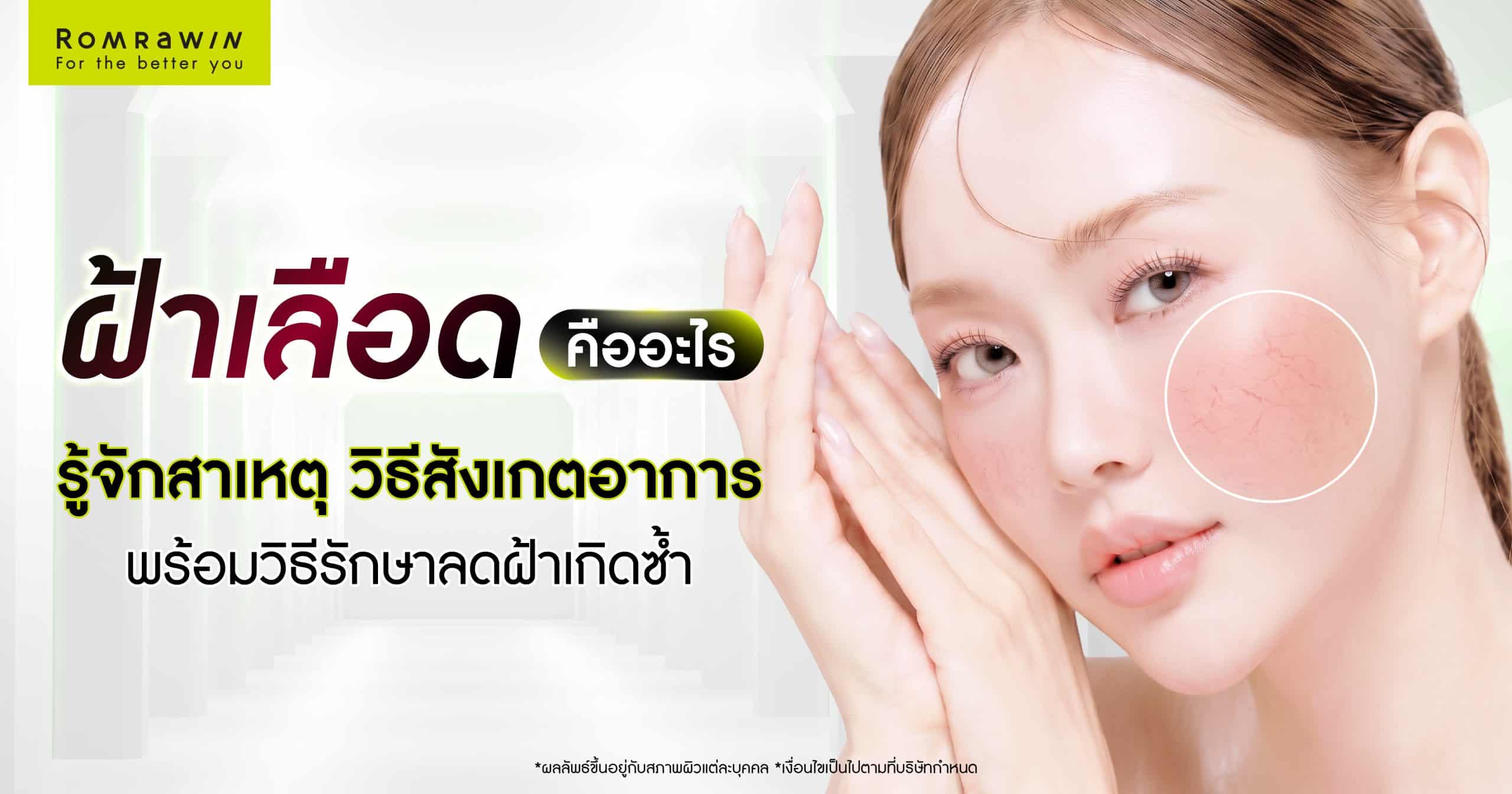 ฝ้าเลือดคืออะไร