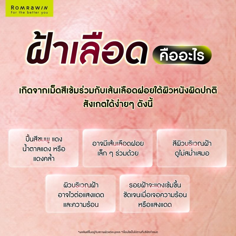 ฝ้าเลือดคืออะไร?