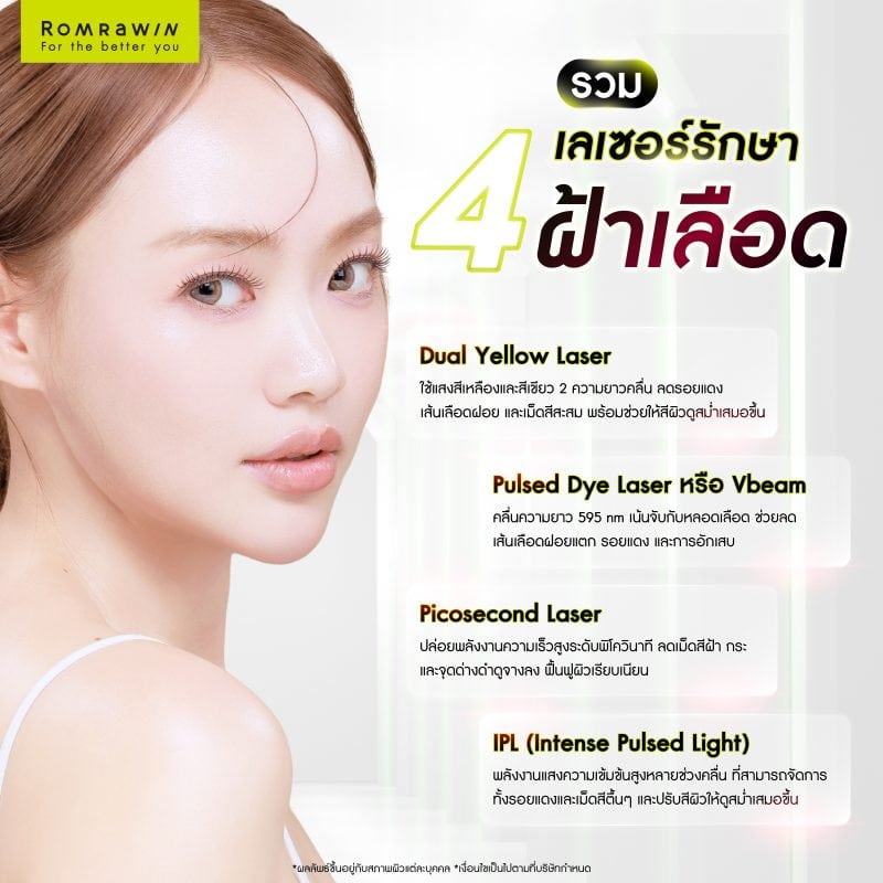 เลเซอร์รักษาฝ้าเลือดคืออะไร มีอะไรบ้าง?
